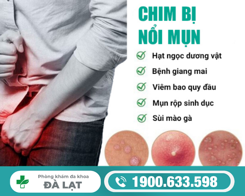 Hình ảnh minh họa